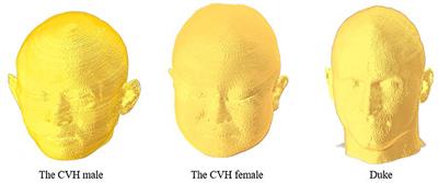 Genetic Algorithm for TMS Coil Position Optimization in Stroke Treatment